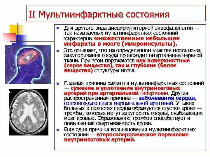 Генез энцефалопатии. Гипертоническая мультиинфарктная энцефалопатия мрт. Дисциркуляторная энцефалопатия стадии. Дисциркуляторная энцефалопатия 2 степени. Дисциркуляторные дистрофические изменения