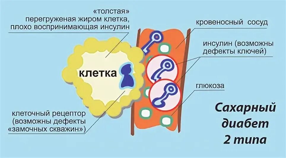 Инсулинорезистентность и сахарный диабет 2 типа. Инсулинорезистентность клетка. клетки чувствительные к инсулину. резистентность к инсулину. инсулинорезистентность сахар.