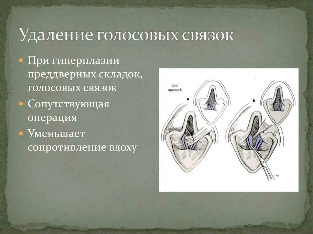 Как восстановить голосовые связки. Голосовые связки у собак. Отрезание голосовыхсвязок. Удаление голосовых связок. Подрезание голосовых связок.