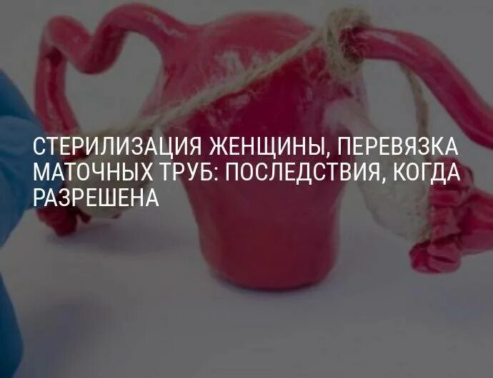 Можно развязать трубы и забеременеть. Перевязка труб последствия. перевязать трубы у женщины. стерилизация женщин плюсы и минусы.