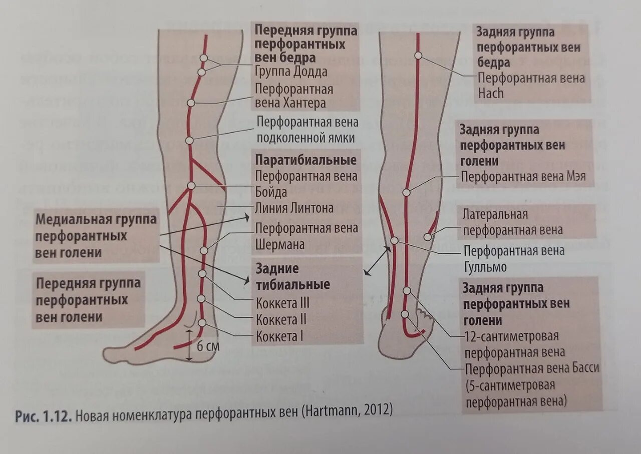 Перфорантные вены нижних конечностей анатомия. Перфорантная Вена в средней трети голени это. Анатомия венозной системы нижних конечностей. Вены нижних конечностей поверхностные и глубокие.