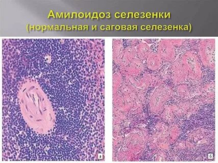Селезенка микропрепарат