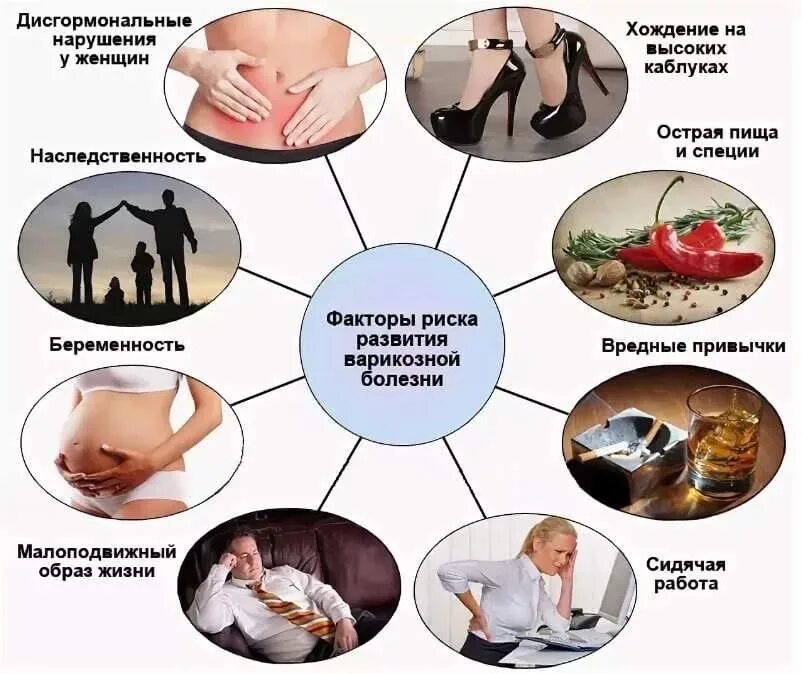 Варикозное расширение вен. Варикоз причины возникновения. Факторы возникновения варикозного расширения вен. Факторы возникновения варикозной болезни. Варикоз причины профилактика.