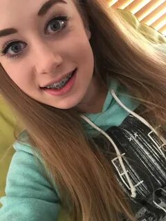 #braces #cute #young #teens #girls #braceface #georgeous Outfit ideas.