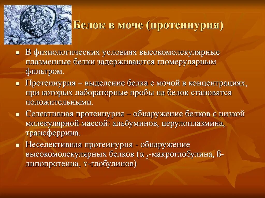 Белок в моче. Белок в моче заболевания. Белок в моче появляется при. Причины появления белка в моче. Белок 0 13