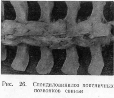 Спондилоартроз поясничного отдела 2 степени