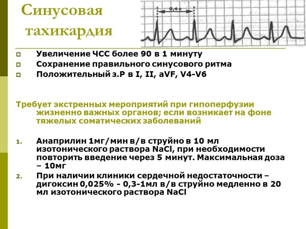 Частота сердечных сокращений характеристика. ЭКГ проявления синусовой тахикардии. Синусовая тахикардия (110 уд/мин). Транзиторная синусовая тахикардия. Синусовая тахикардия ЧСС 106.