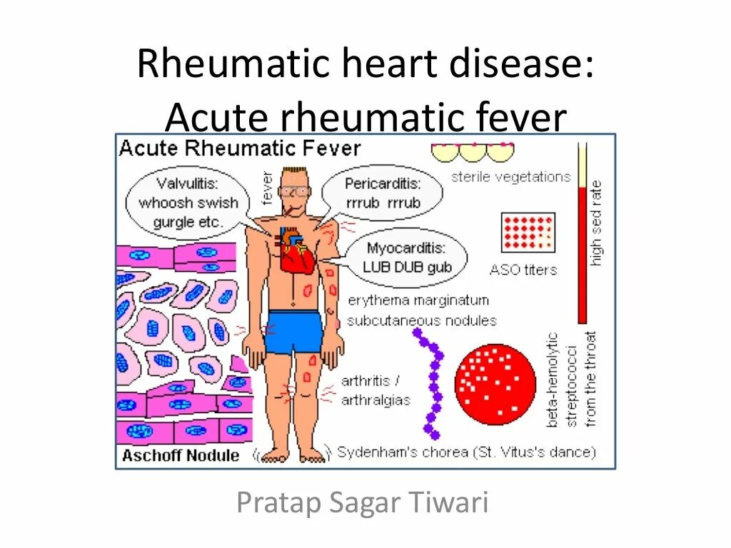 Acute diseases. Acute diseases. Acute diseases. Disease or illness difference. Acute meaning.