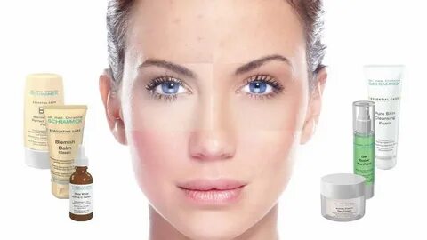Skin had