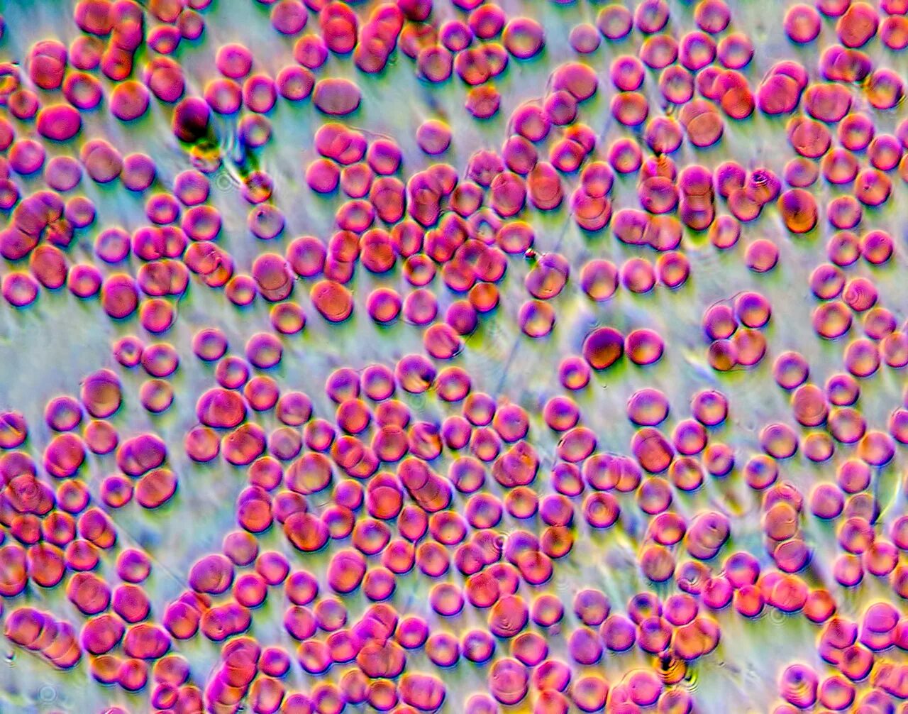 Эритроциты в крови микроскоп. Эритроциты микрофотография. Эритроциты человека под микроскопом. Кровь человека под микроскопом.