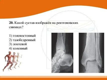 4 локти