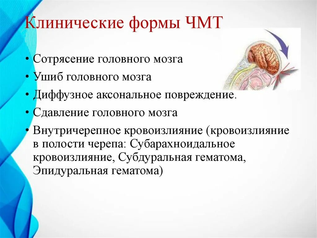 Чмт у детей. Чмт клинические рекомендации. клинические формы чмт. клинические формы очмт.