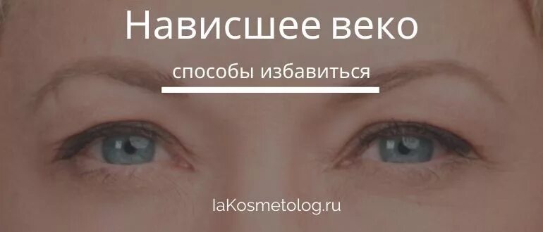 Верхние веки темного цвета. Нависшее верхнее веко что делать