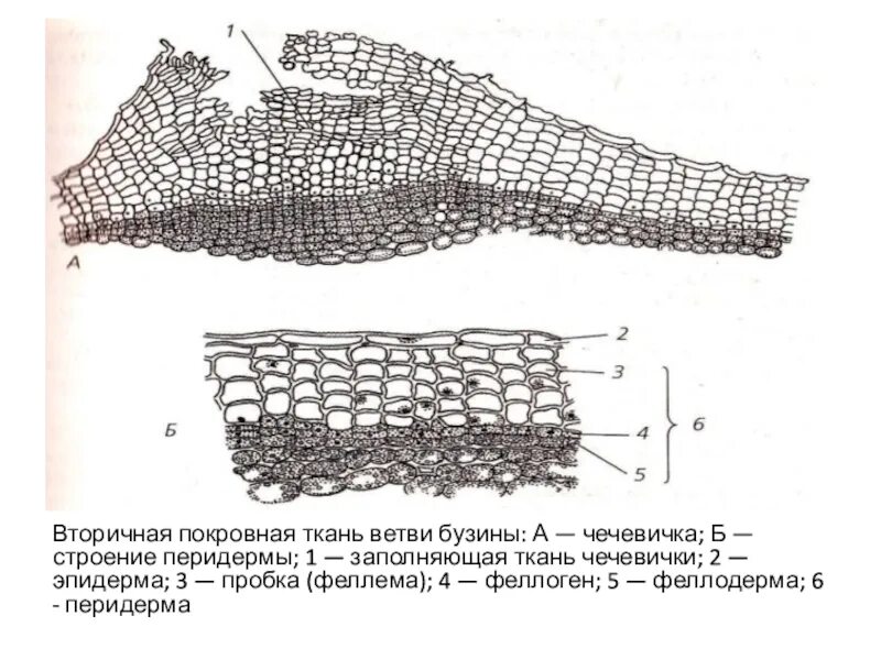 Чечевички бузины. Перидерма и чечевички бузины. Поперечный срез перидермы стебля бузины. Чечевички бузины. Строение перидермы и чечевички бузины.