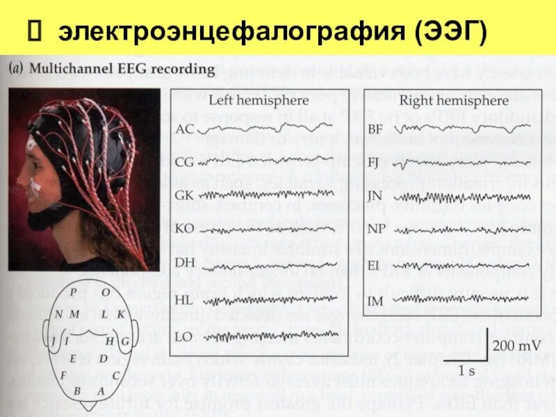 Ээг челны. ЭЭГ. ЭЭГ психофизиология. Электроэнцефалография (ЭЭГ). Наложение электродов ЭЭГ.