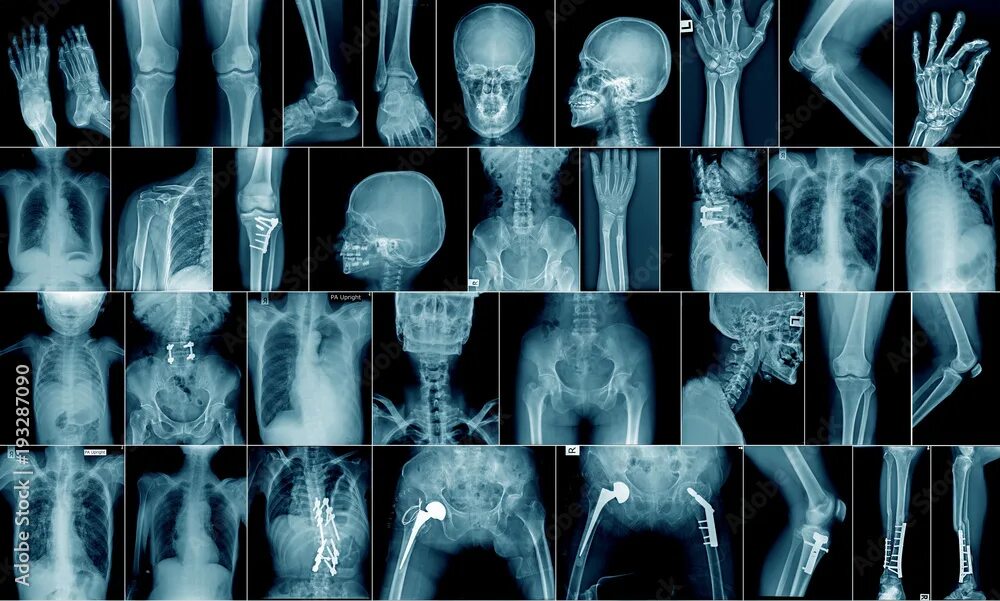 Рентген делают в одежде или нет. X-ray рентген. рентгеновские снимки. рентгеновский снимок человека. рентгенография костей.