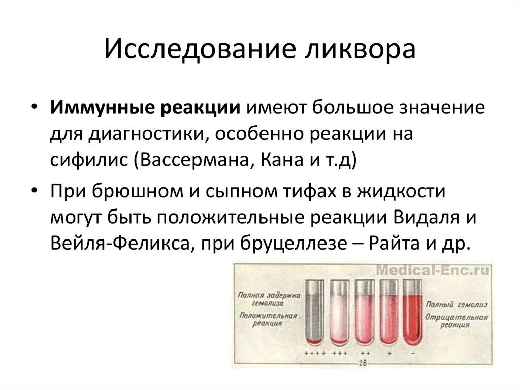 Исследование ликвора. Реакция ликвора. Ксантохромный цвет ликвора. Серологическое исследование ликвора.