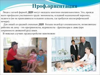 Легкая форма дцп