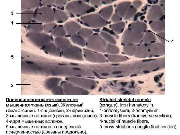Поперечно полосатая мышечная ткань Железный гематоксилин гистология. Мышечная ткань окраска железным гематоксилином. Поперечно полосатая мышечная ткань окраска Железный гематоксилин. Мышцы гистология препарат. Препарат поперечно полосатая мышечная ткань