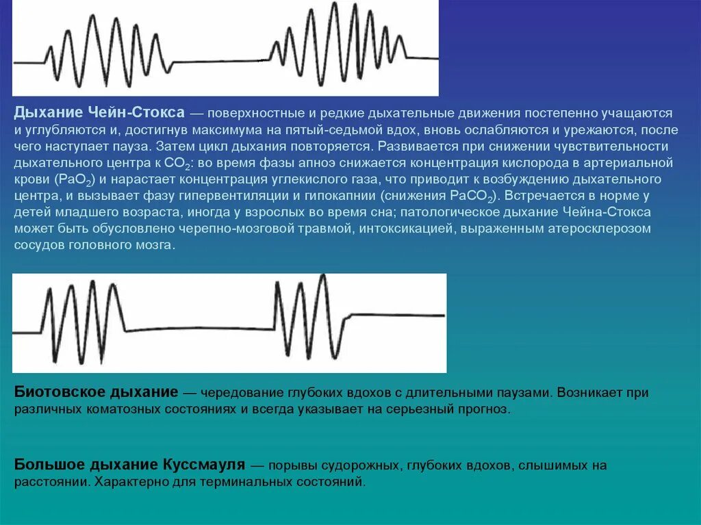 Дыхание 1 уровень. Дыхание Чейна-Стокса спирограмма. Дыхание Биота Чейна Стокса Куссмауля. Чейн Стокса Куссмауля. Механизм развития дыхания Чейна Стокса.