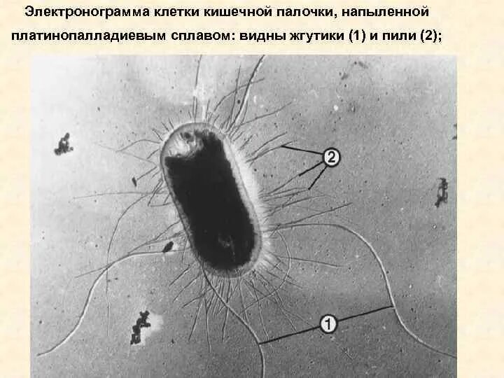 Строение бактерии микрофотографии. Прокариотическая клетка в микроскопе. Нуклеоид это в микробиологии. Жгутик микрофотография. Бактериальная клетка электронная микрофотография.