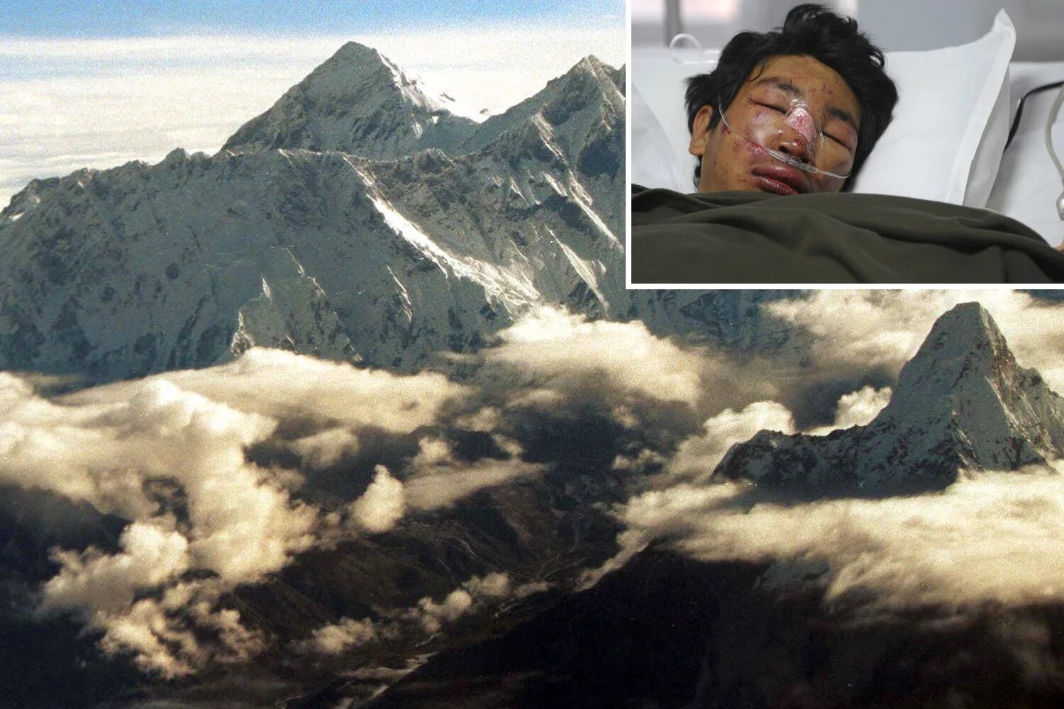 Как выглядит горе человека Adventure Medical Kits on Mt. Everest Flickr