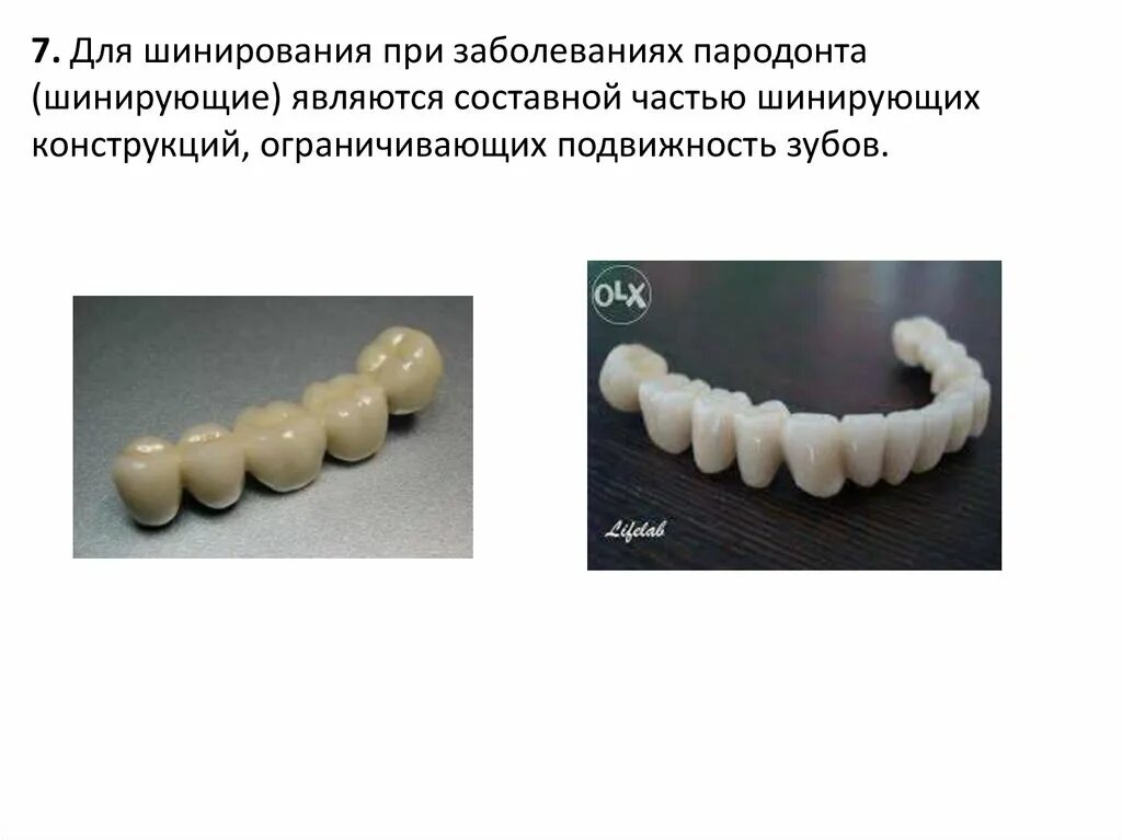 Классификация коронки зуба. Искусственные зубы. искусственные коронки. искусственные коронки шинирующие.
