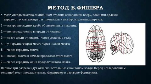 Метод мозга