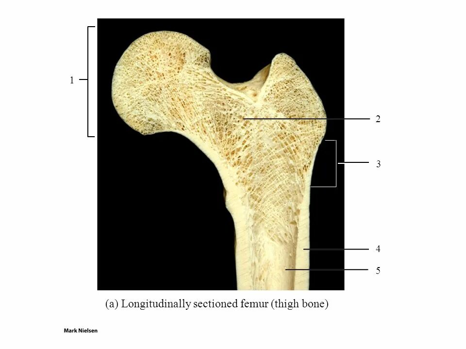 Bone meaning. Bone structure. bone one. spongy bone meaning. шлифт или шлиф кости.