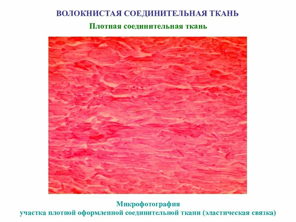 Плотная соединительная ткань строение. Плотная эластическая соединительная ткань. плотная оформленная соединительная ткань эластическая связка. эластическая волокнистая соединительная. плотная волокнистая соединительная ткань эластического типа.