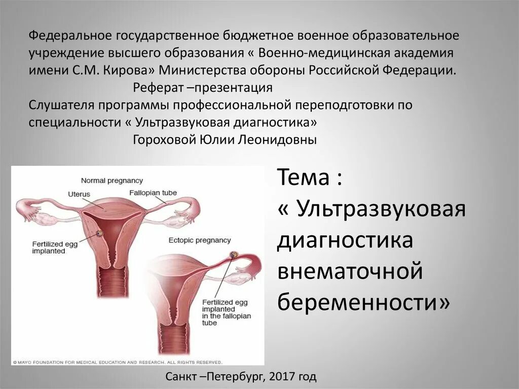 Диагноз внематочная беременность. Диагностика внематочной беременности. Эктопическая беременность диагностика. Ультразвуковая диагностика внематочной беременности. Диагностика при внематочной беременности.