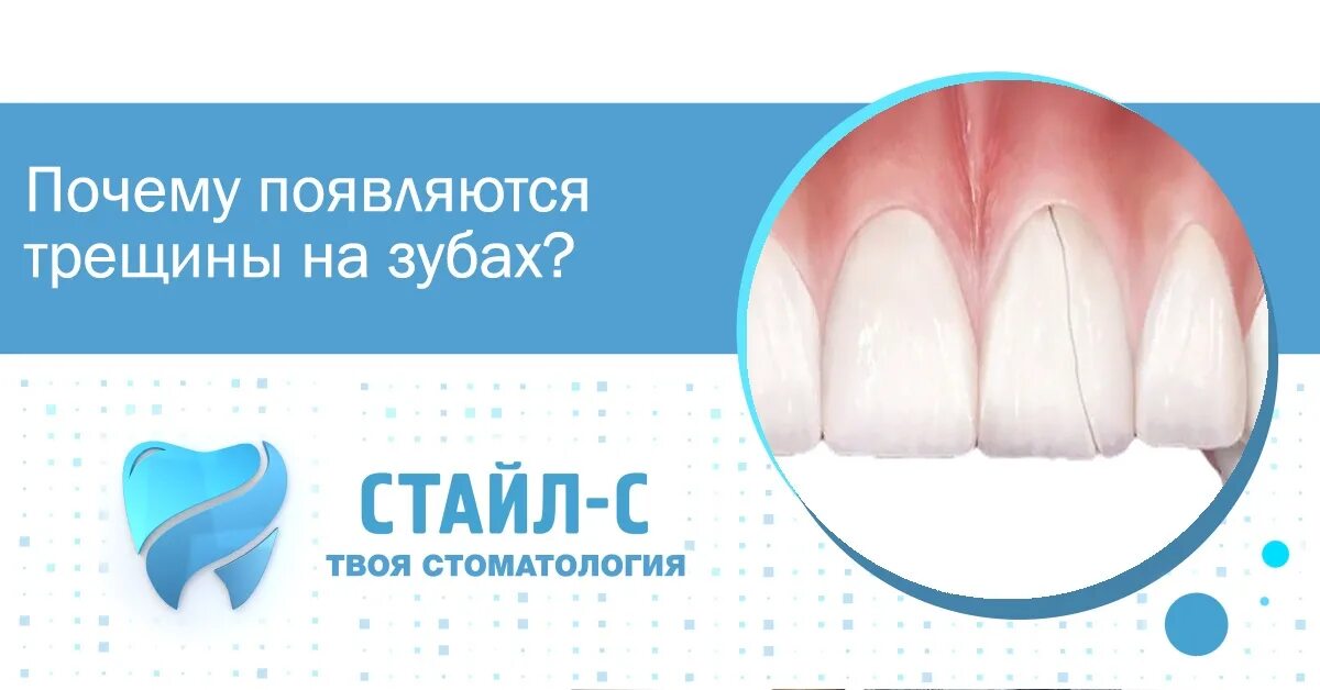 Причины трещин заднего прохода. Простейшие укрытия. Причины образования трещин в сварных швах. Почему щель. Почему щель.