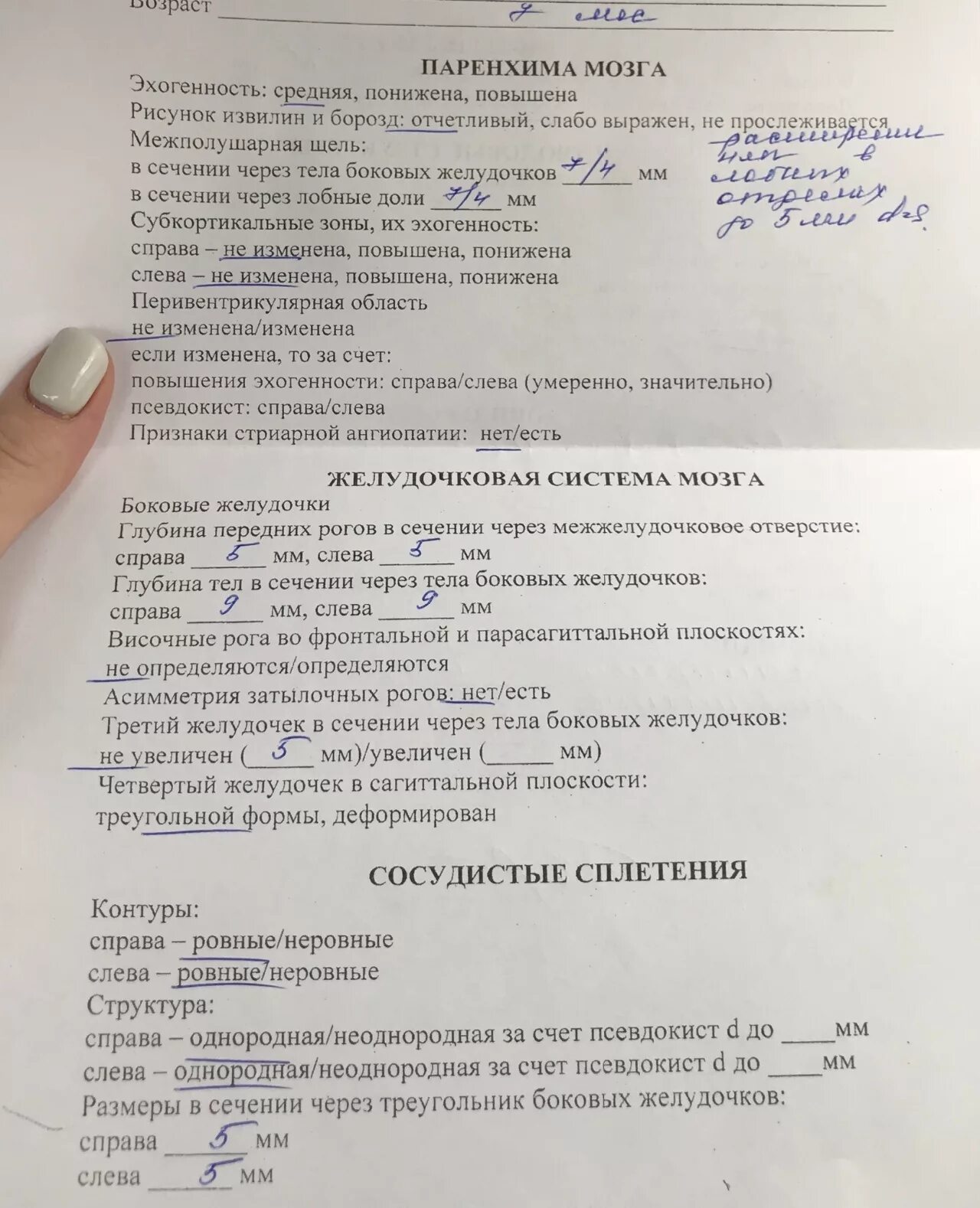 Мозг 20 недель. Боковые рога головного мозга норма у плода. Норма боковых желудочков головного мозга у плода. Задние рога боковых желудочков УЗИ. Боковые желудочки головного мозга по УЗИ У плода.