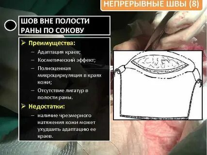 Вне полости