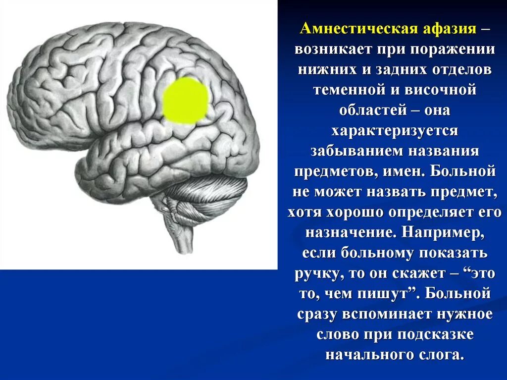 Номинативная функция речи при афазии. Очаг поражения при амнестической афазии. амнестическая афазия возникает при поражении. локализации поражения головного мозга при афазии. локализация очага при амнестической афазии.