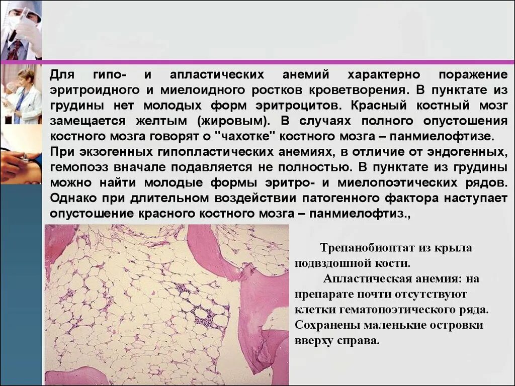 Апластическая анемия красный костный мозг. Костный мозг при апластической анемии. Костный мозг при апластической анемии описание. Костный мозг при гипопластической анемии.