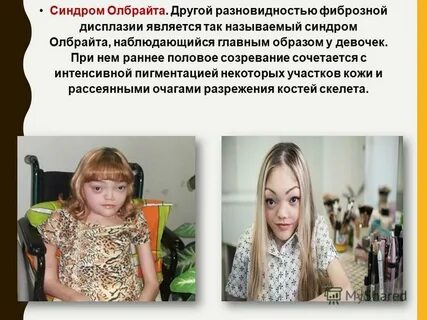 Синдром мака