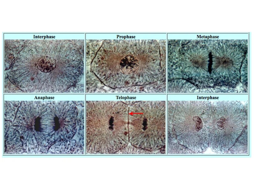 Изучение фаз митоза на фиксированном препарате метод. Метафаза митоза микроскоп. Митоз микропрепарат. Анафаза митоза под микроскопом. Клетки в митозе гистология.