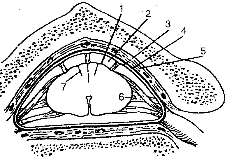 Рис. 2 - оболочки спинного мозга. Оболочки и МЕЖОБОЛОЧЕЧНЫЕ пространства спинного мозга. МЕЖОБОЛОЧЕЧНЫЕ пространства спинного мозга. Твердая оболочка спинного мозга.