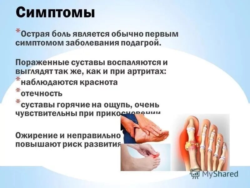 Подагра симптомы у мужчин простыми словами. Подагра симптомы у мужчин простыми словами. Подагра симптомы у мужчин простыми словами. Подагра развивается при нарушении. Поражение легких при подагре.