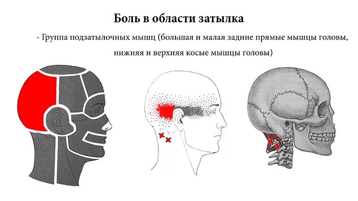 Голова болит сбоку. Болит правая сторона головы причины сбоку.