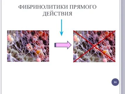 Фибринолитики