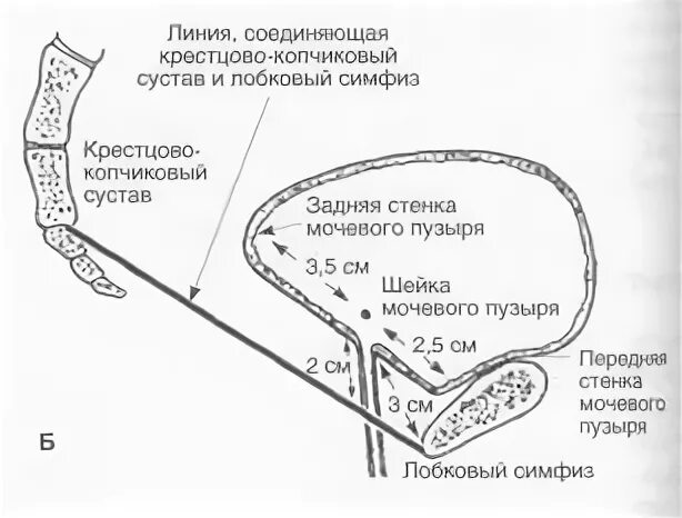 Размер мочевого пузыря у мужчин. Сегменты мочевого пузыря схема. Задний уретровезикальный угол. Уретровезикальный угол по УЗИ. Уретровезикального сегмента.