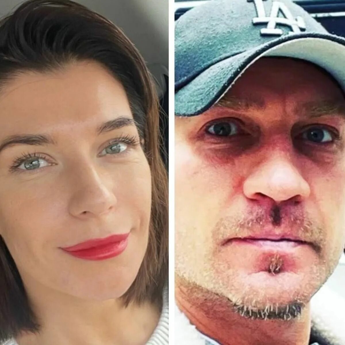 Роману ампутировали. Костомаров ампутировали ноги и руки. Костомаров ампутировали стопы. Костомаров до болезни фото. Ампутированные конечности костомарова.