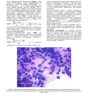 Пролиферация железистого эпителия nilm