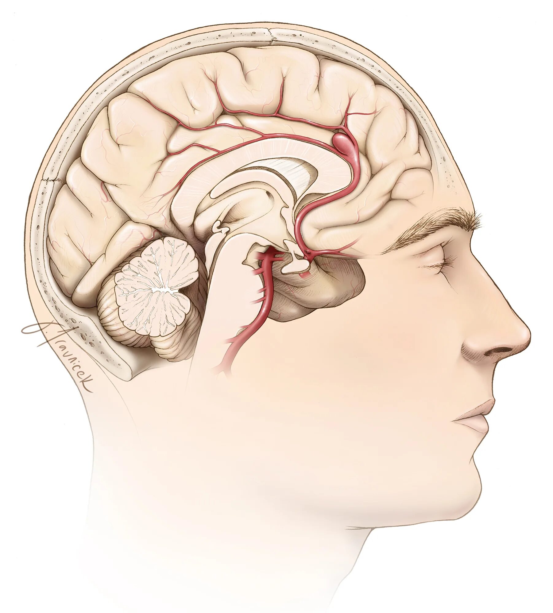 Железа мозга 7. Краниотомия головного мозга. Краниофарингиома. Краниофарингиома человек.