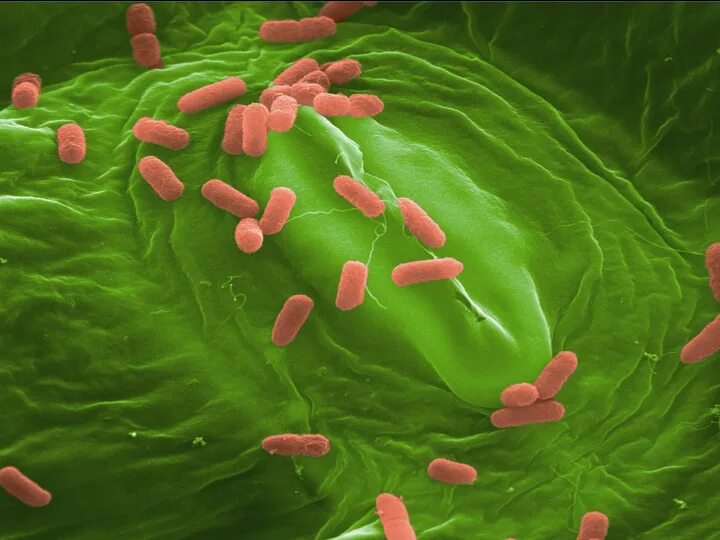 Salmonella enterica. Бактерия сальмонелла. Сальмонелла Зонне. Вирус сальмонеллы. Сальмонелла под микроскопом.