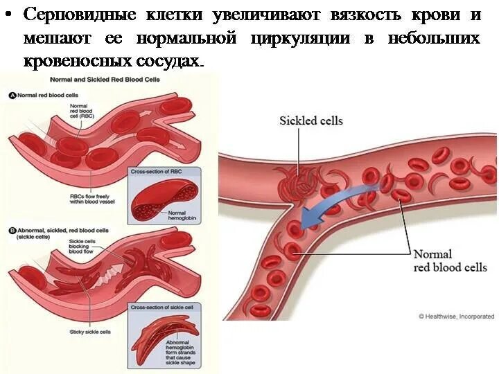 Факторы увеличивающие вязкость крови. Причины увеличения вязкости крови. Факторы повышающие вязкость крови. Улучшение вязкости крови.