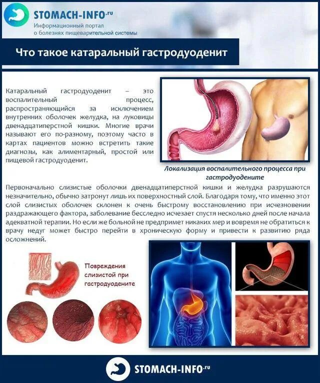 Основные клинические проявления хронического гастродуоденита. Гастродуоденит хронический 1 степени. Симптомы дуоденита гастродуоденита. Гастродуоденит 12 перстной кишки. Хронический гастродуоденит лечение у взрослых