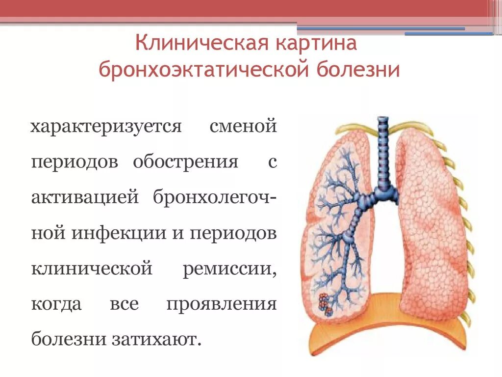 Бронхит бронхоэктатическая болезнь. Бронхоэктатическая болезнь. Бронхоэктатической болезни. Бронхоктический болезнь. Обострение бронхоэктатической болезни.